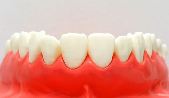 前歯の模型