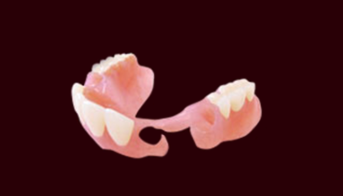 ノンクラスプ義歯の画像